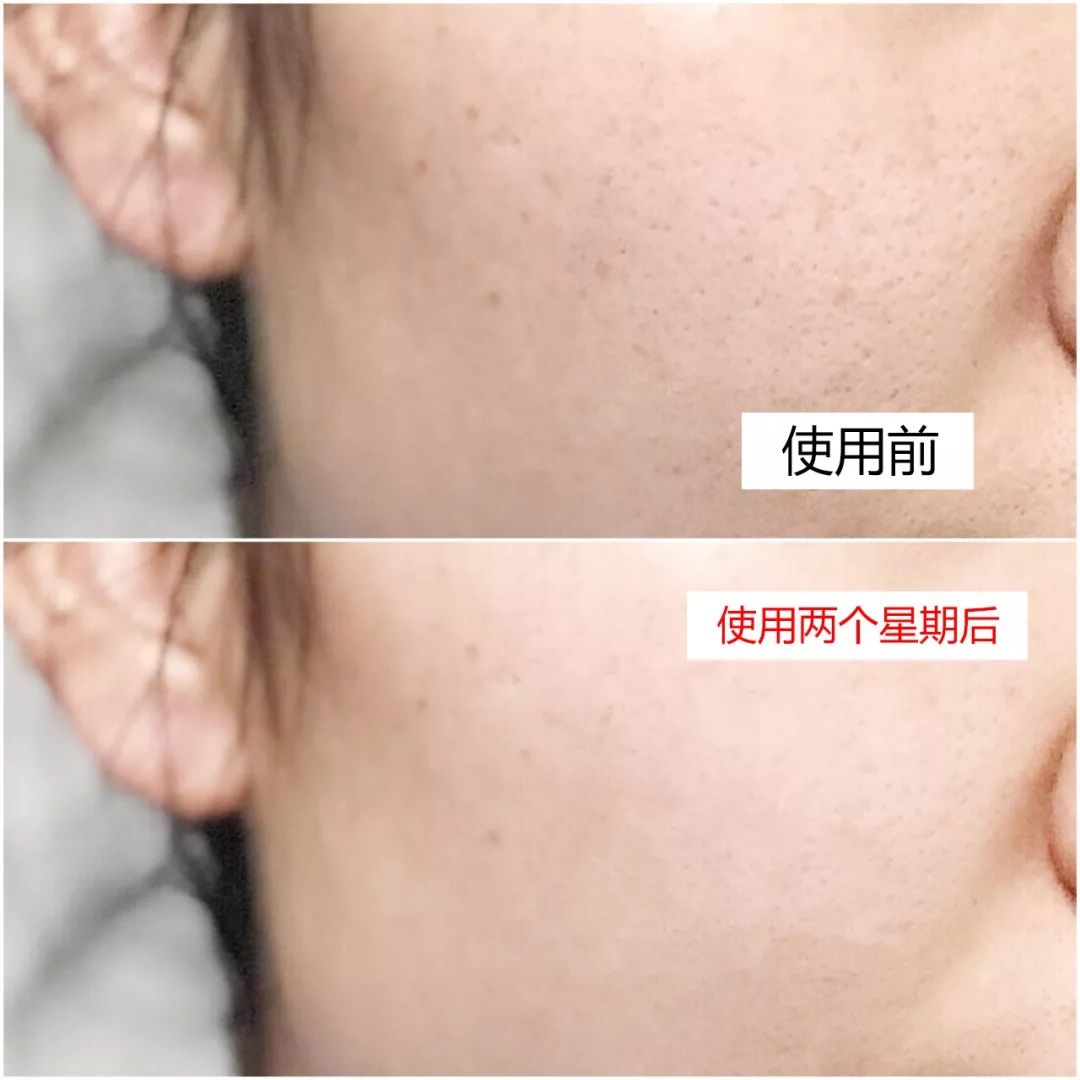 美白祛黄提亮肤色精华推荐李佳琦,李佳琦美白淡斑面膜去黄提亮肤色