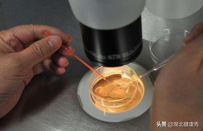 试管取完卵卵巢多久会恢复好,试管取完卵对卵巢有多大伤害