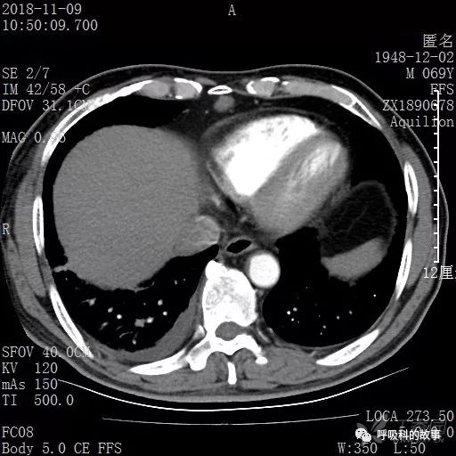 怎么应用统计学做调查,统计学方法可以解决的主要问题