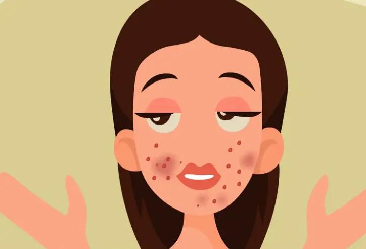 俏肌草本祛痘,俏肌龄祛痘精华液怎么用