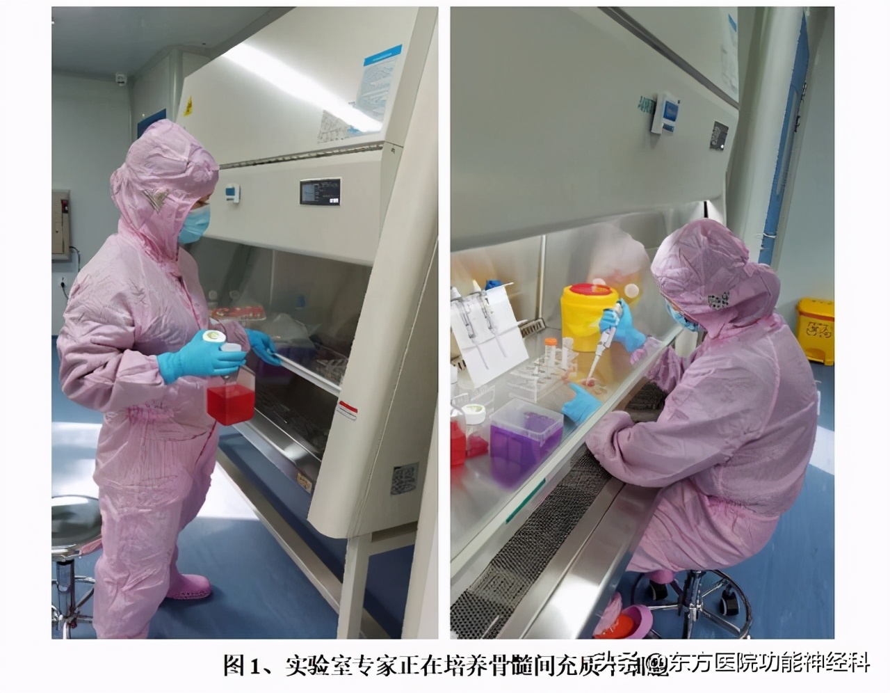 干细胞移植治疗脑中风后遗症进展,干细胞治疗缺血性卒中