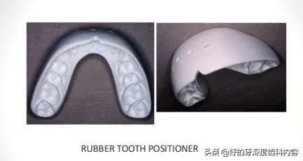 隐形牙套和普通隐形牙套,隐形牙套到底有多可怕