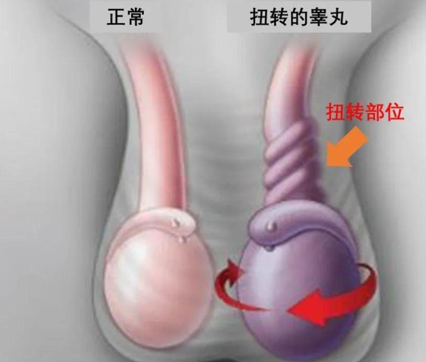 涓轰粈涔堜笉鐩镐俊鍖荤敓,涓轰粈涔堝ぇ浜轰笉鐩镐俊鍖荤敓