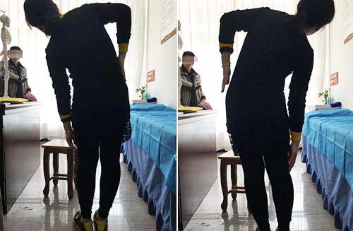 强直反复发作真的无计可施吗 (强直为什么反复发作)