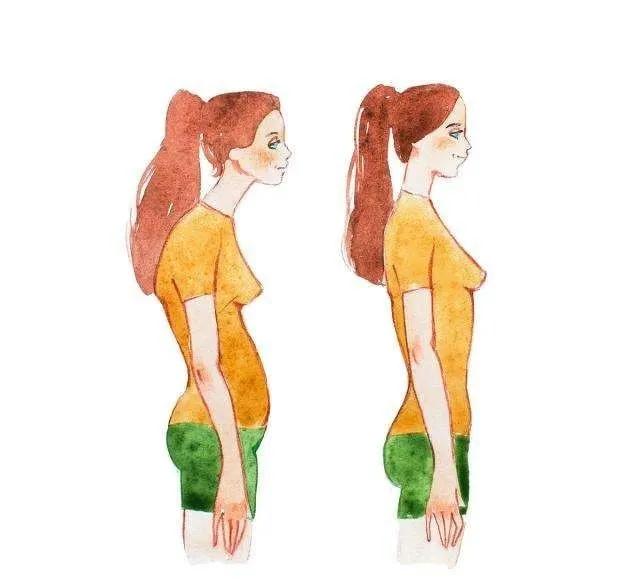 产后含胸驼背能纠正吗,产后脖子后背发凉不舒服怎么办