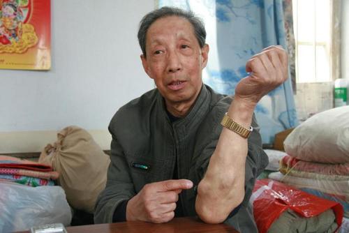 皮肤上长疙瘩怎么消除,皮肤下出现疙瘩是什么原因