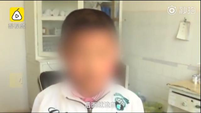 男童反复流鼻血竟是一条大蚂蝗,5岁男孩取出蚂蟥