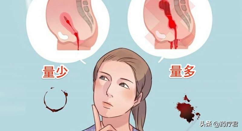 女生来例假有血块怎么回事正常吗,女生来例假有血块什么原因