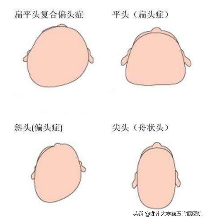 郑州大学五附院康复科怎么样,郑州大学五附院儿科