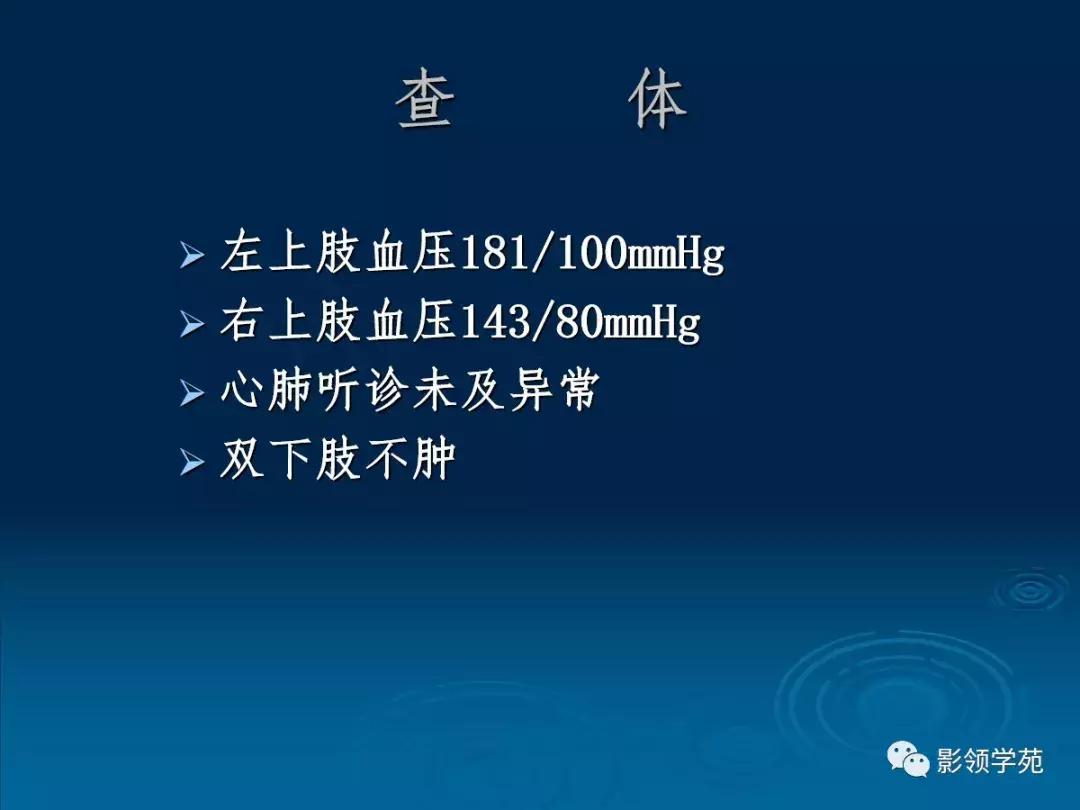 主动脉壁间血肿护理查房,主动脉夹层和壁间血肿图片
