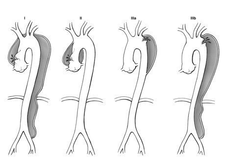 胸痛中心最常见的三种病,胸痛的四大杀手分别是什么