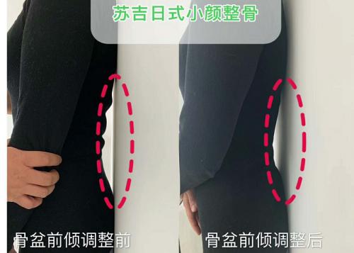 盆骨胀痛是什么原因,来大姨妈盆骨两侧酸胀