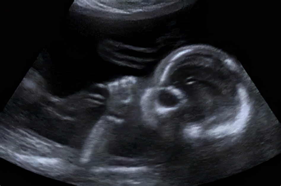 3岁小孩总吃手怎么戒掉,孩子四岁了还老是吃手怎么教育