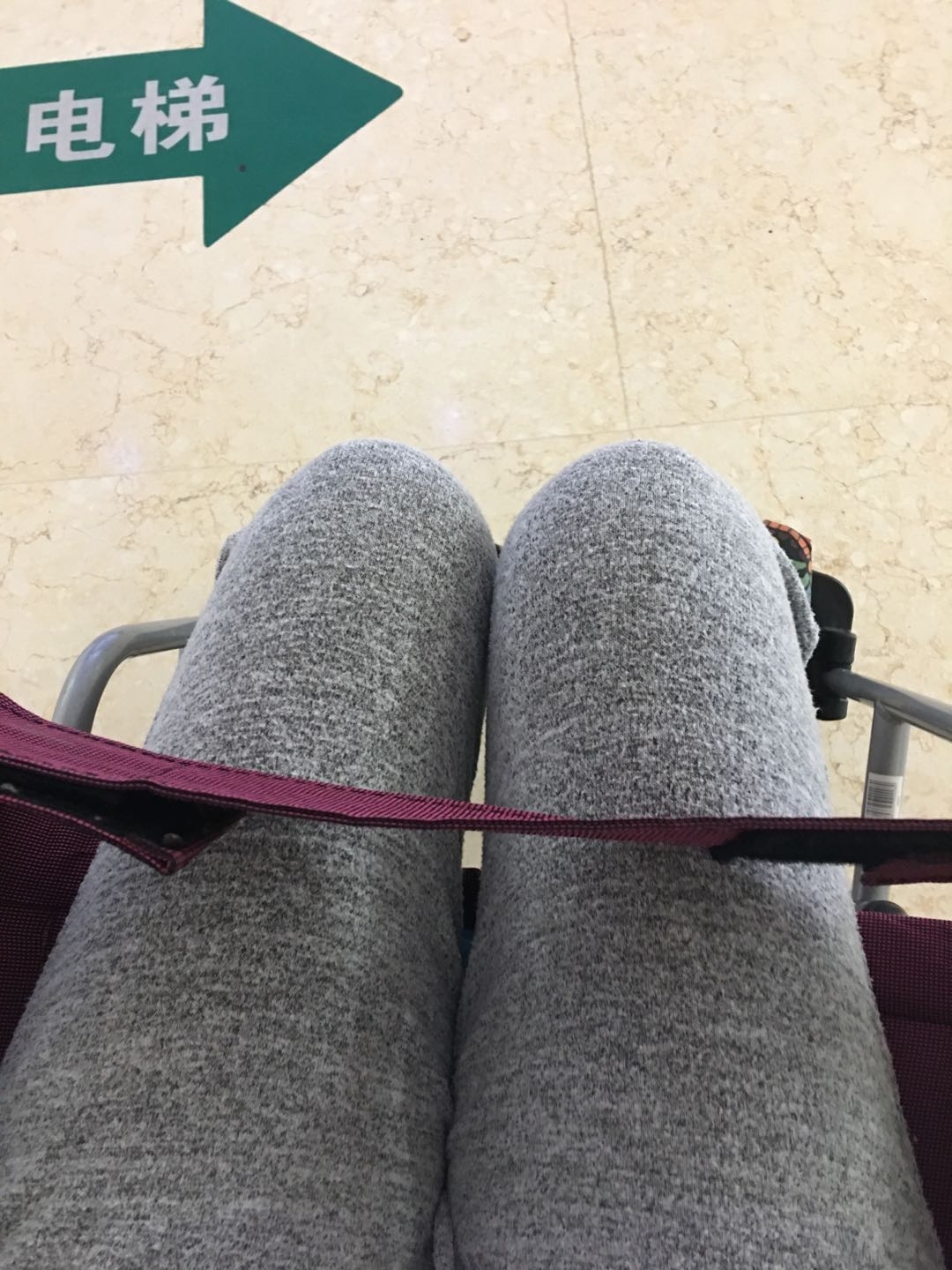 两次宫外孕是运气差吗,两次宫外孕左右各一边