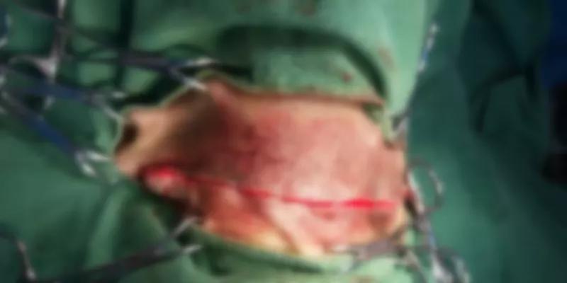 狗狗颈部有个包块是正常的吗,狗狗下巴有肿块用什么药治疗