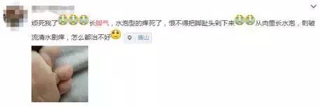 快！闻闻你的脚！听说蛮多武汉伢都有脚气