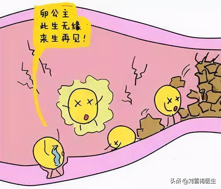 刘雪梅医生科普：流产后一直怀不上，为什么建议你尽快去做造影