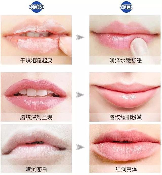 邓紫棋小红瓶,邓紫棋的金鱼嘴视频