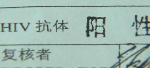 女性感染艾滋初期有什么症状,怎么知道目前感染艾滋病的阶段