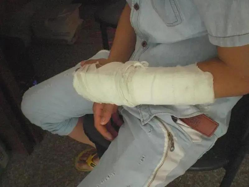 手机充电爆炸前有什么预兆,手机充电玩手机爆炸是什么引起的