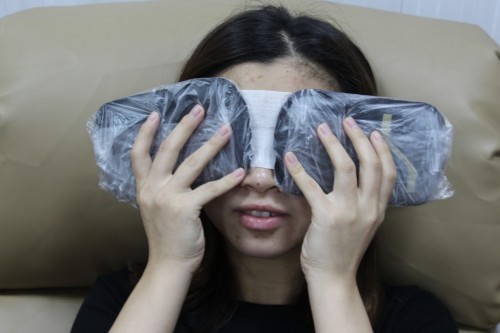 修志夫做双眼皮效果怎么样,修志夫双眼皮修复