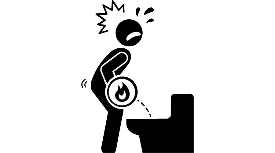 小便时出现疼痛感是什么原因,小便时有点痛是什么原因