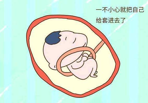 生活在宫腔“小黑屋”里，宝宝们每天都干嘛？看完感觉有点可爱