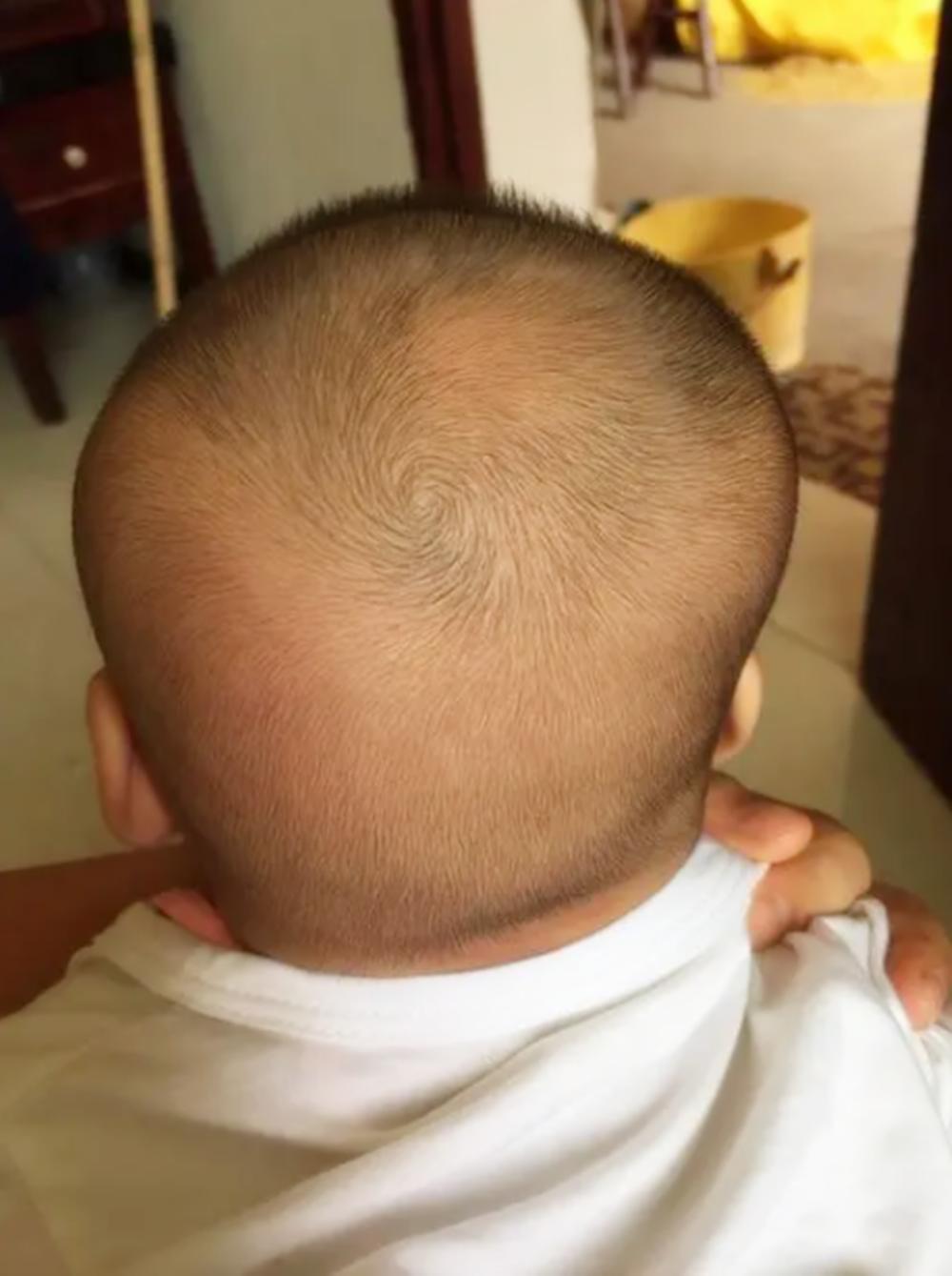 孩子头型偏了是不是扎辫子都不正,5个月宝宝头型不正还可以纠正吗