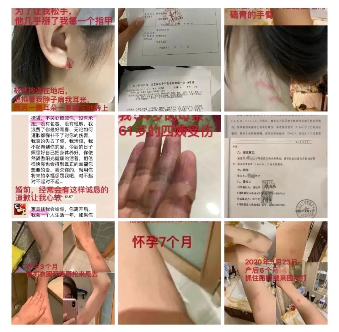 世界冠军家暴妻子,世界冠军女子拳击手被家暴