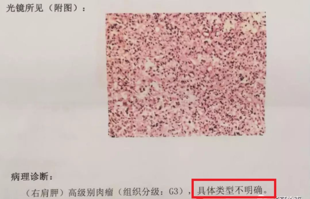 身上长很多包是什么癌,身上长包块去什么医院