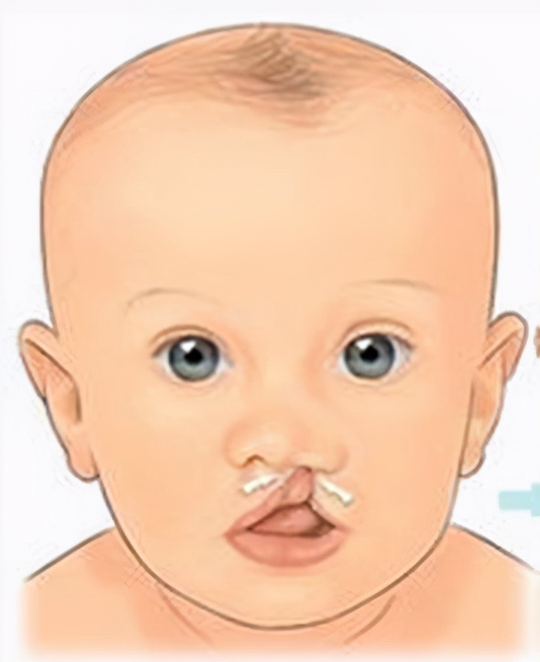 深圳市免费孕前优生检查怎么办理,孕前优生健康检查是婚前还是婚后