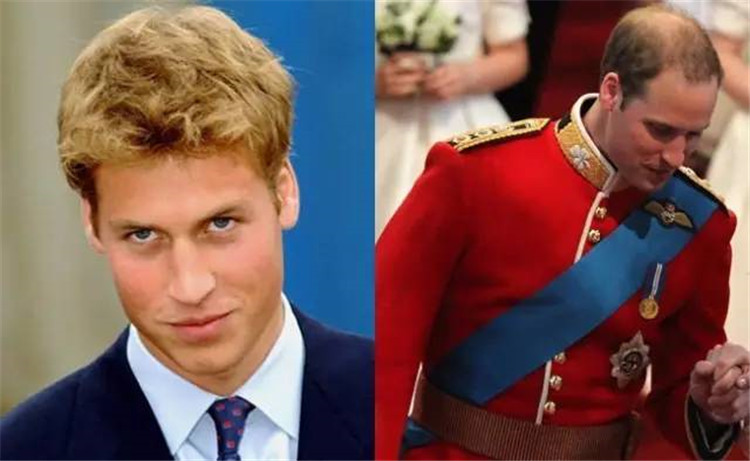 贝克汉姆头秃,贝克汉姆秃了头