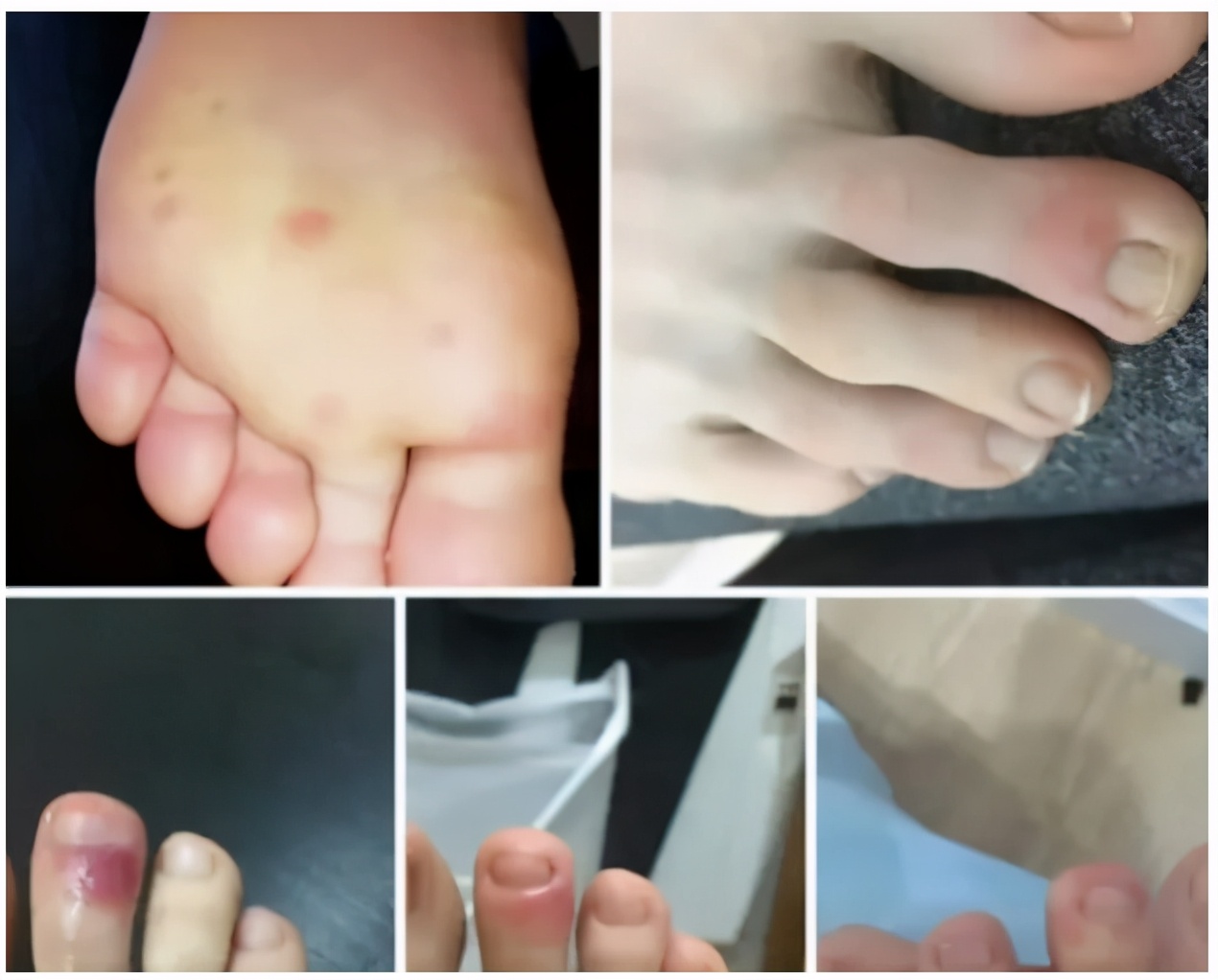 不明原因发热的常见原因及特点,长期不明原因的发热诊治经验