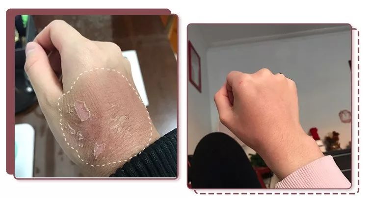 蔡依林护肤视频,蔡依林皮肤特护霜