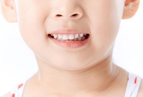 提醒家长关注幼儿换牙问题,换牙期父母要知道的