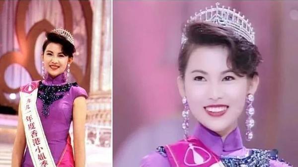 蔡少芬上节目打疫苗,蔡少芬录节目时被狗咬伤