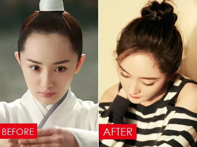 拯救发际线告别大额头,拯救发际线不走冤枉路