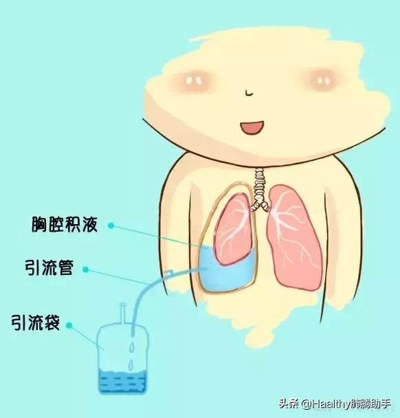 喘不上气的漫画,喘不过气的漫画