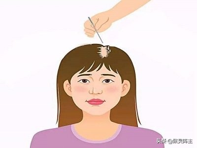 头发防脱产品排行榜 (头发控油防脱)