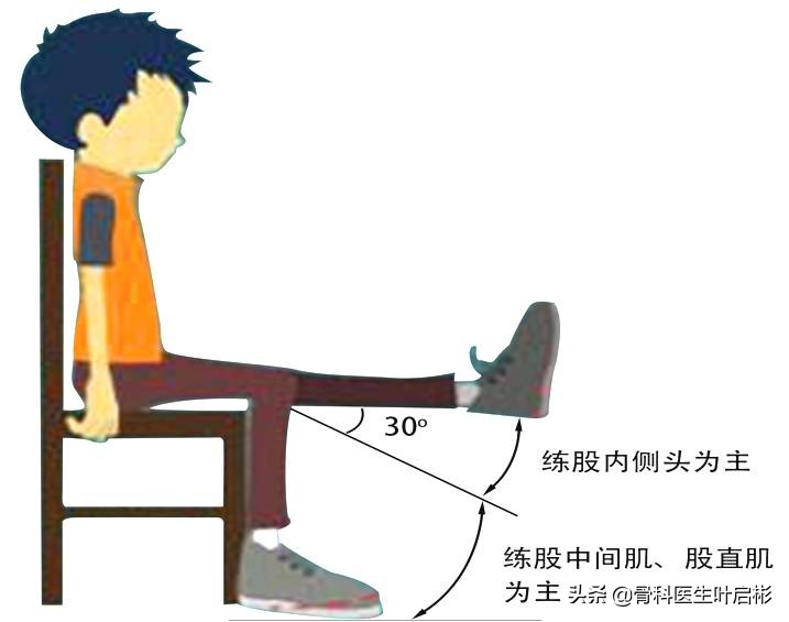 髌骨软化症髌骨矫正,髌骨软化半脱位怎么治疗才能治愈