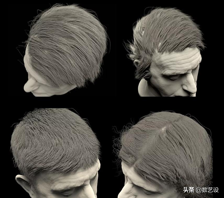 脱发过程3d动画,脱发有救了