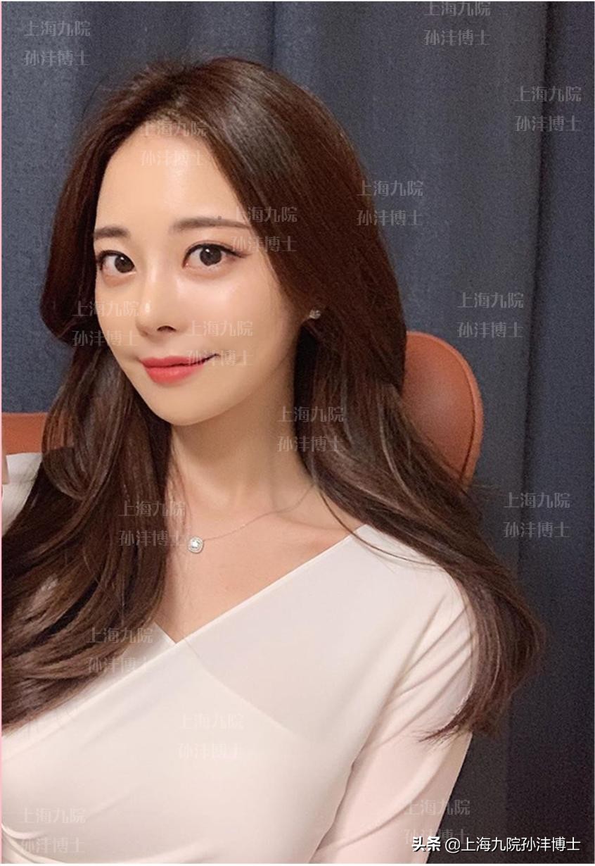 上海九院孙沣博士眼角修复,眼修复能找原来医生修复吗
