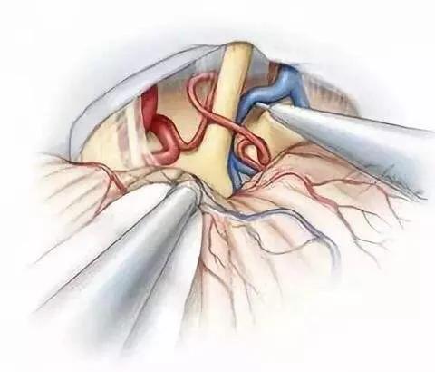 太阳穴和牙疼是不是三叉神经痛,牙疼下巴疼脸也疼是三叉神经疼吗