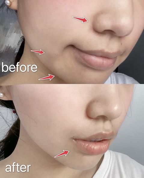 韩束面膜美白淡化色斑,韩束发光面膜