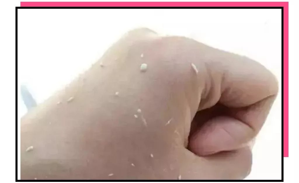 护肤品搓泥该怎么办,护肤品搓泥有没有什么好的办法