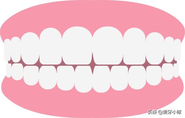 牙齿问题困扰和误区,不容忽视的牙齿问题