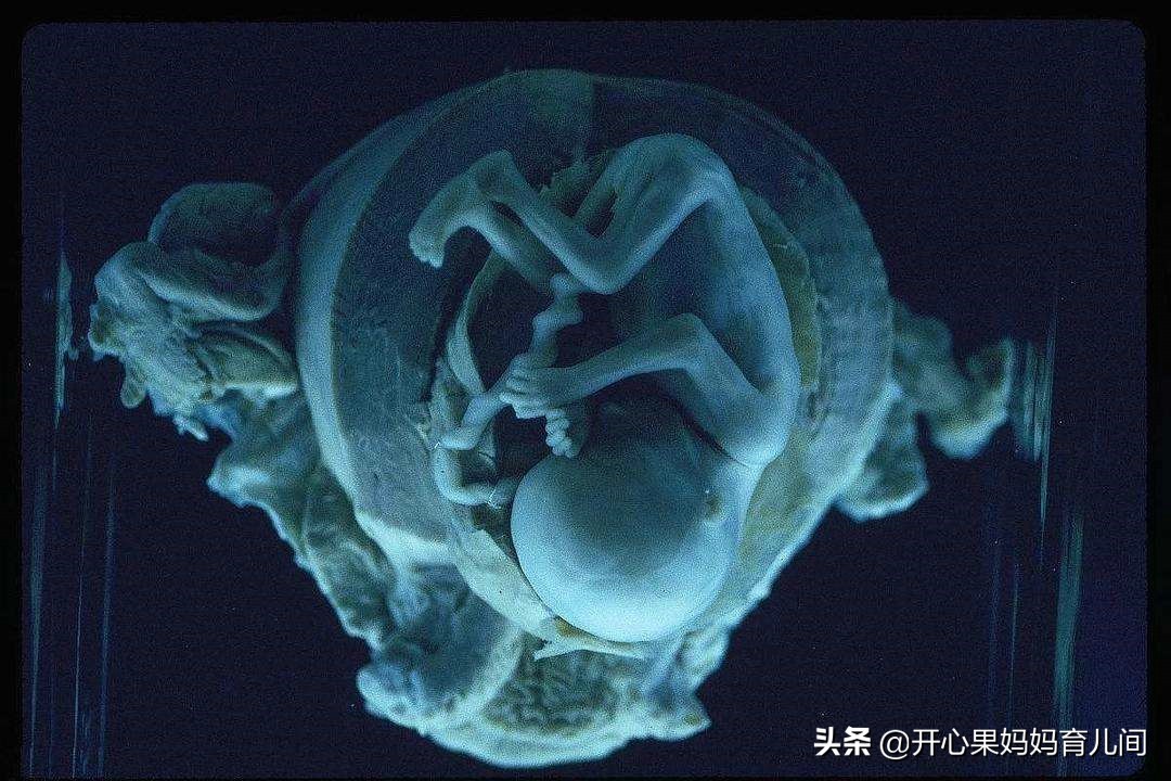 孕妇引起假性宫缩的原因,孕妇多少周开始会出现假性宫缩