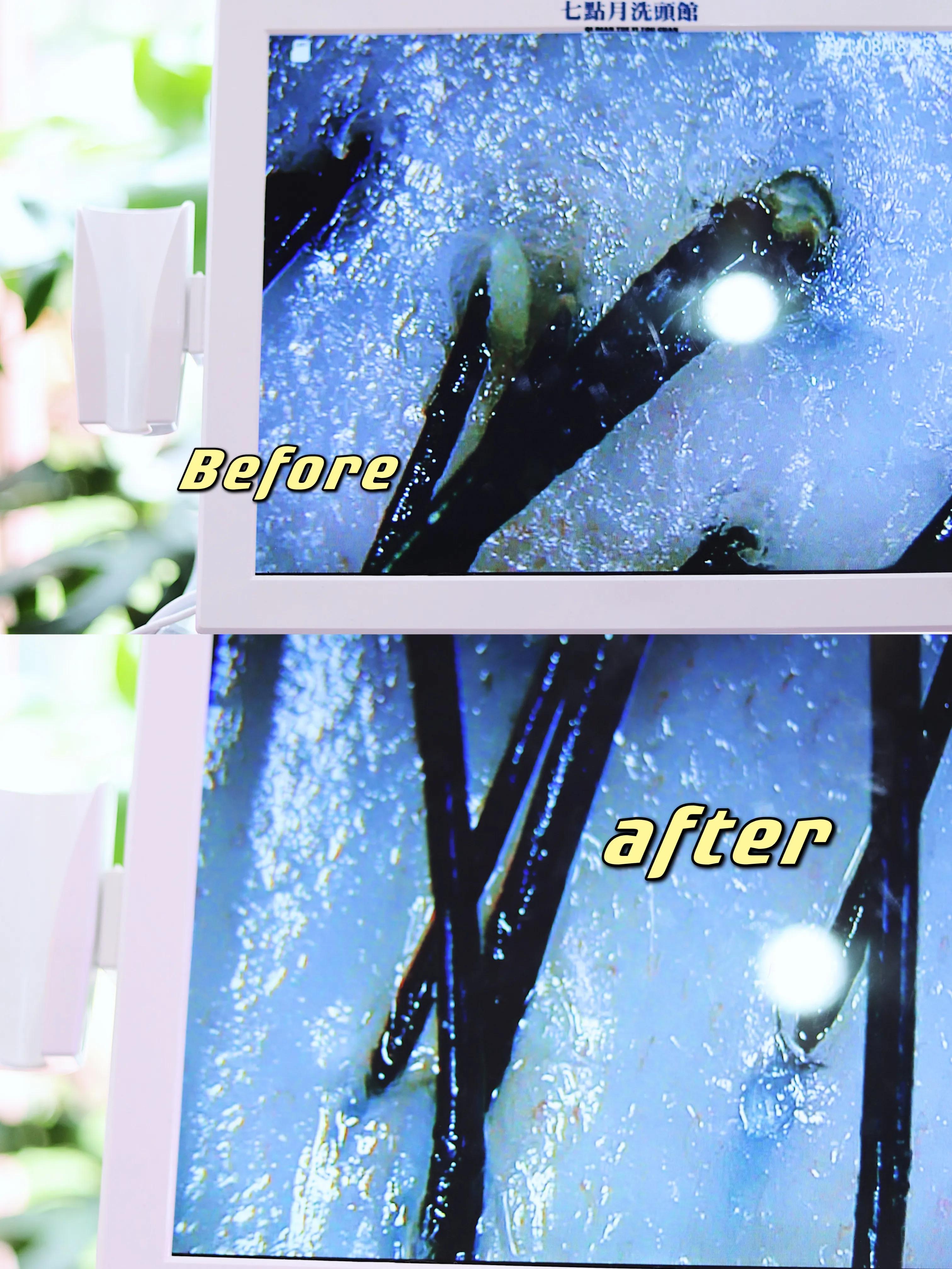 重庆日式碳酸泉头皮护理免费咨询,重庆碳酸泉头发护理