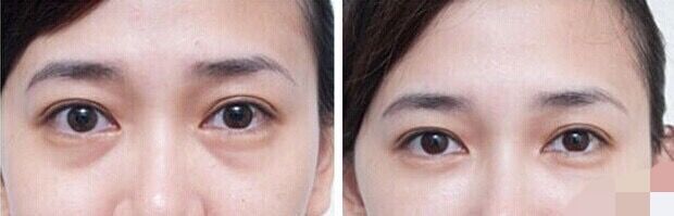 干燥皮肤美妆护理步骤有哪些,美妆教程日常化妆干性皮肤用什么