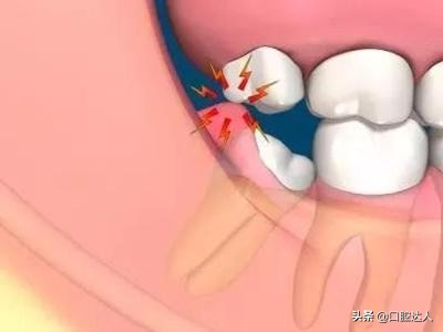 “它”可能给你的长假带来*麻大**烦!医生:早发现,早治疗
